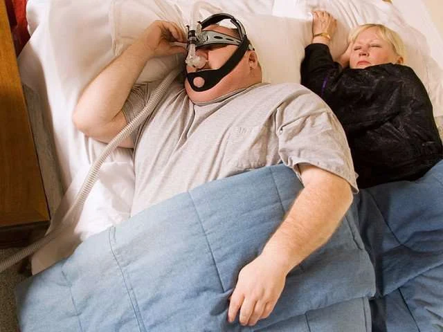 CPAP mouth breather