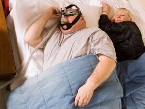 Dry mouth with CPAP